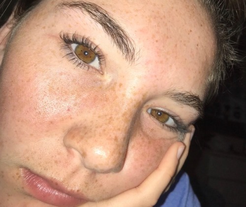 freckles-and-luv:i kind of like my ugly colored eyes