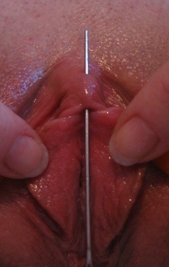 Tumbex Keres Keres Nirvana Genital Mod Genital Modification