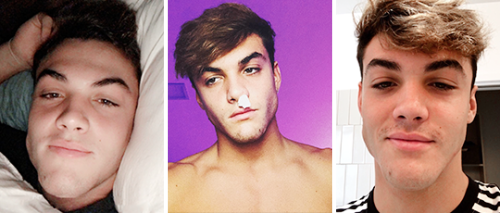 punishmedolans:grayson x selfies