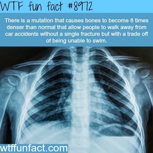 wtf-fun-factss:Worlds densest bones - WTF fun fact