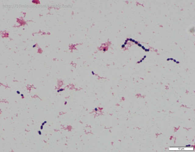 MICROCOSM | Streptococcus suis: yet another zoonotic...