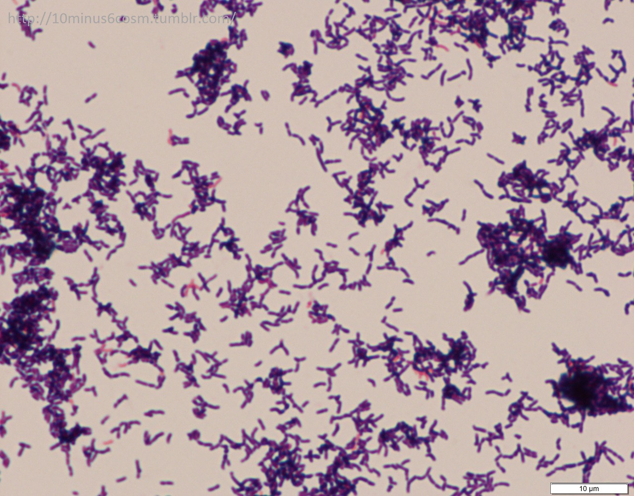 MICROCOSM | Arcanobacterium haemolyticum: An under-recognized...