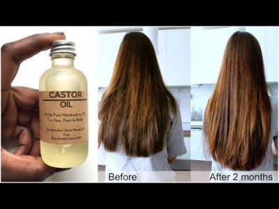 Castor Oil Hair Growth Before And After Pictures
