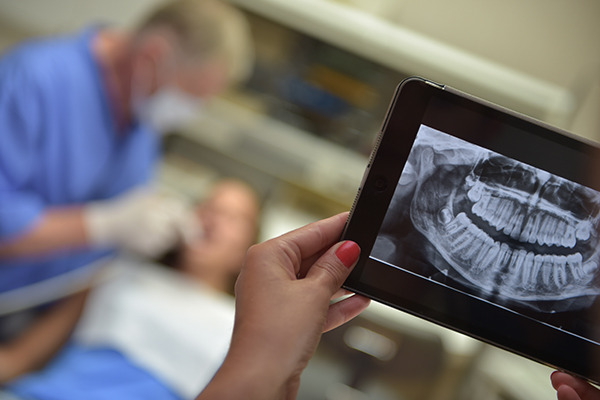 Dental Services — The additional deep cleaning procedure