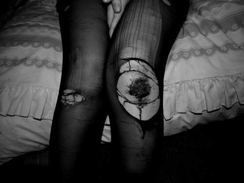 beforeimskinny:✨grunge bruised thinspo - before i’m skinny✨