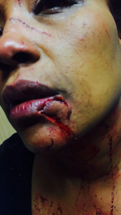 getinmelanin011:angryhijabi:MUSLIM WOMAN SAVAGELY BEATEN FOR...