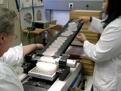 Here Comes the BigBrain, a 3-D Model at Nearly Cellular Resolution
