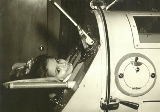 nbcnews: 60 years in an iron lung: US polio...