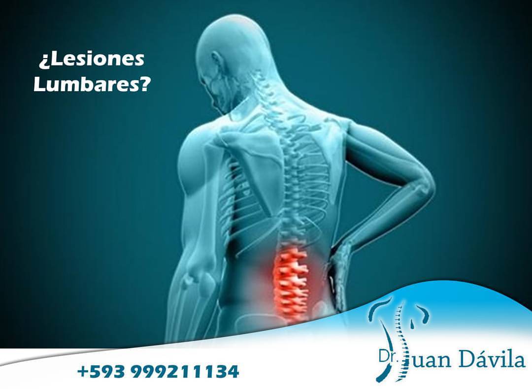 DRJUANDAVILA — La columna cervical tiene normalmente una...