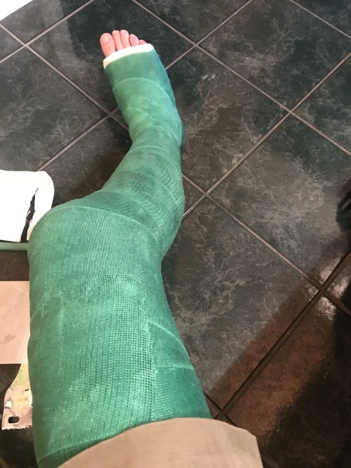 leg cast on Tumblr