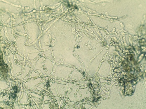 Powdery mildew fungi (Phyllactinia fraxini) on ash (Fraxinus...