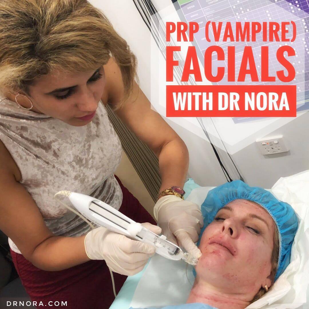 Vampire Facials!It’s the latest craze that has all the celebs signing up, from Kim Kardashian to Kylie Minogue. But what is it and how does it work?
The ‘Vampire facial’ uses Platelet Rich Plasma (PRP), which has been around for almost 20 years. PRP...
