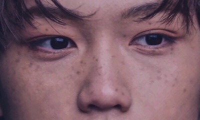 lee felix's freckles | Tumblr