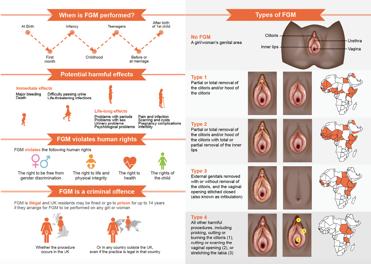 After augmentation and breast before pictures After augmentation and breast before pictures