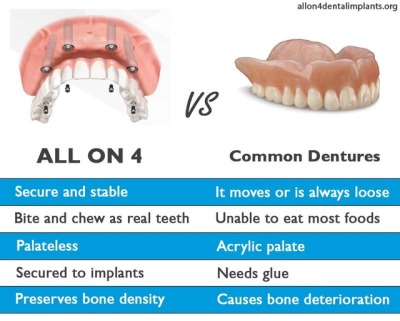 Dentist Brisbane Southside