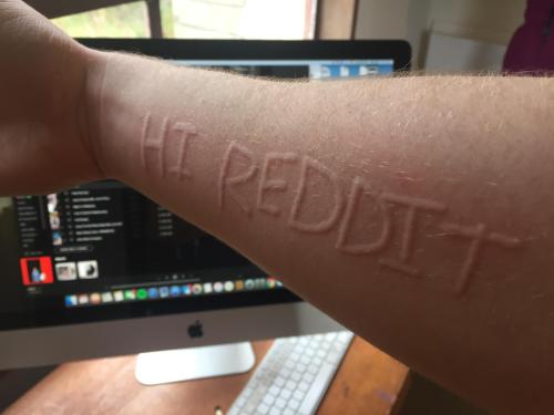 itsmypart