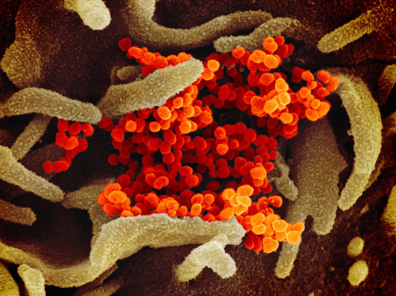 Microscopio Coronavirus