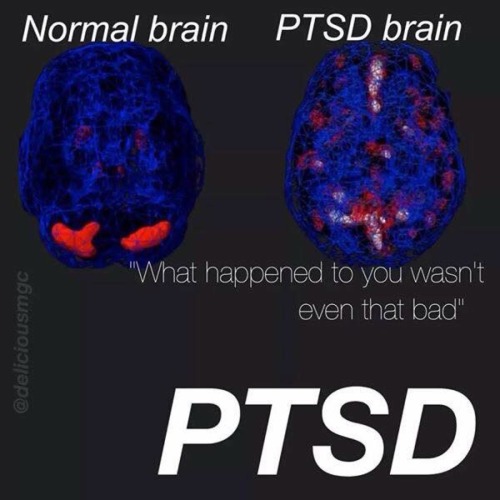 bpmagazine:Just because you can’t see it doesn’t mean mental...