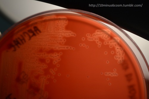 Microcosm Arcanobacterium Haemolyticum An Under Recognized