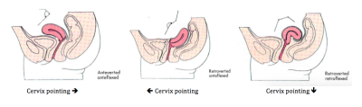 Top Porn Images - Cervix video of dipping for sperm Anny aurora cumshot compilation