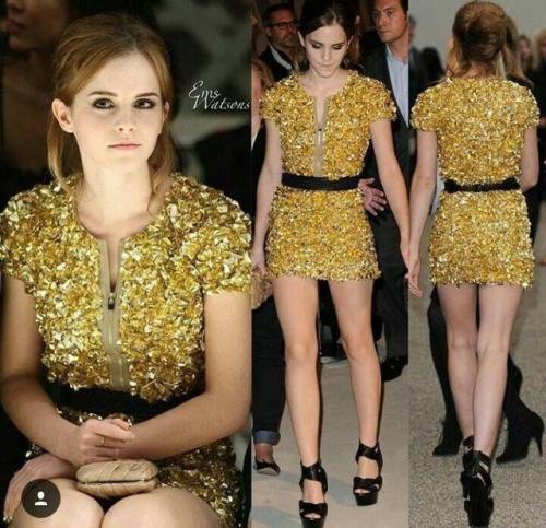 dailyemmawatson101:Really great legs via /r/EmmaWatson...