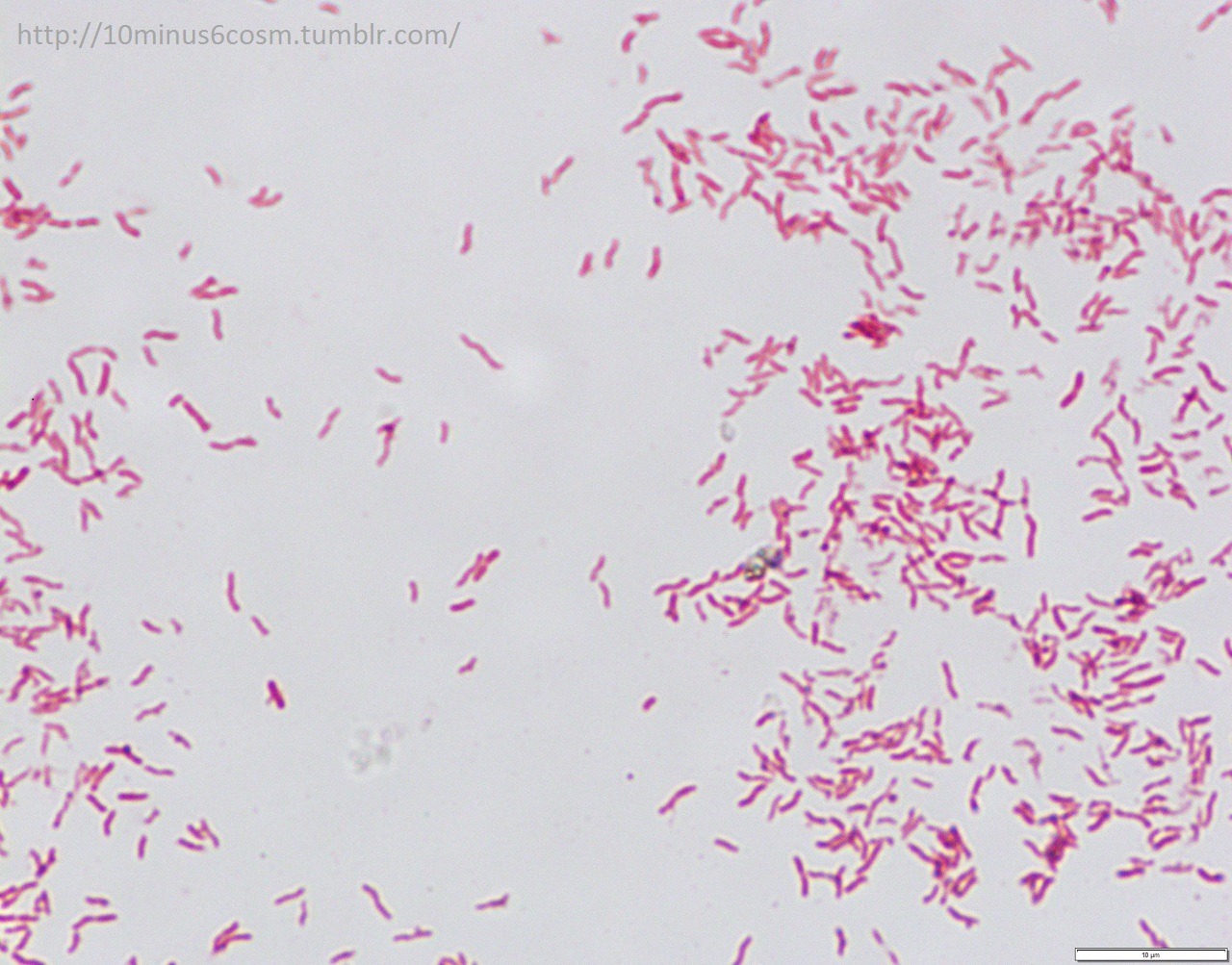 MICROCOSM | Laribacter hongkongensis