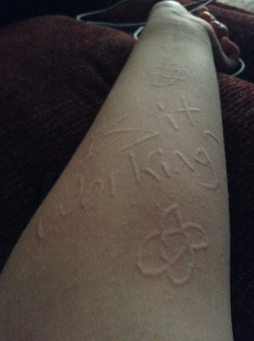 dermatographic urticaria on Tumblr