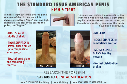 Circumcision Penis Size 74