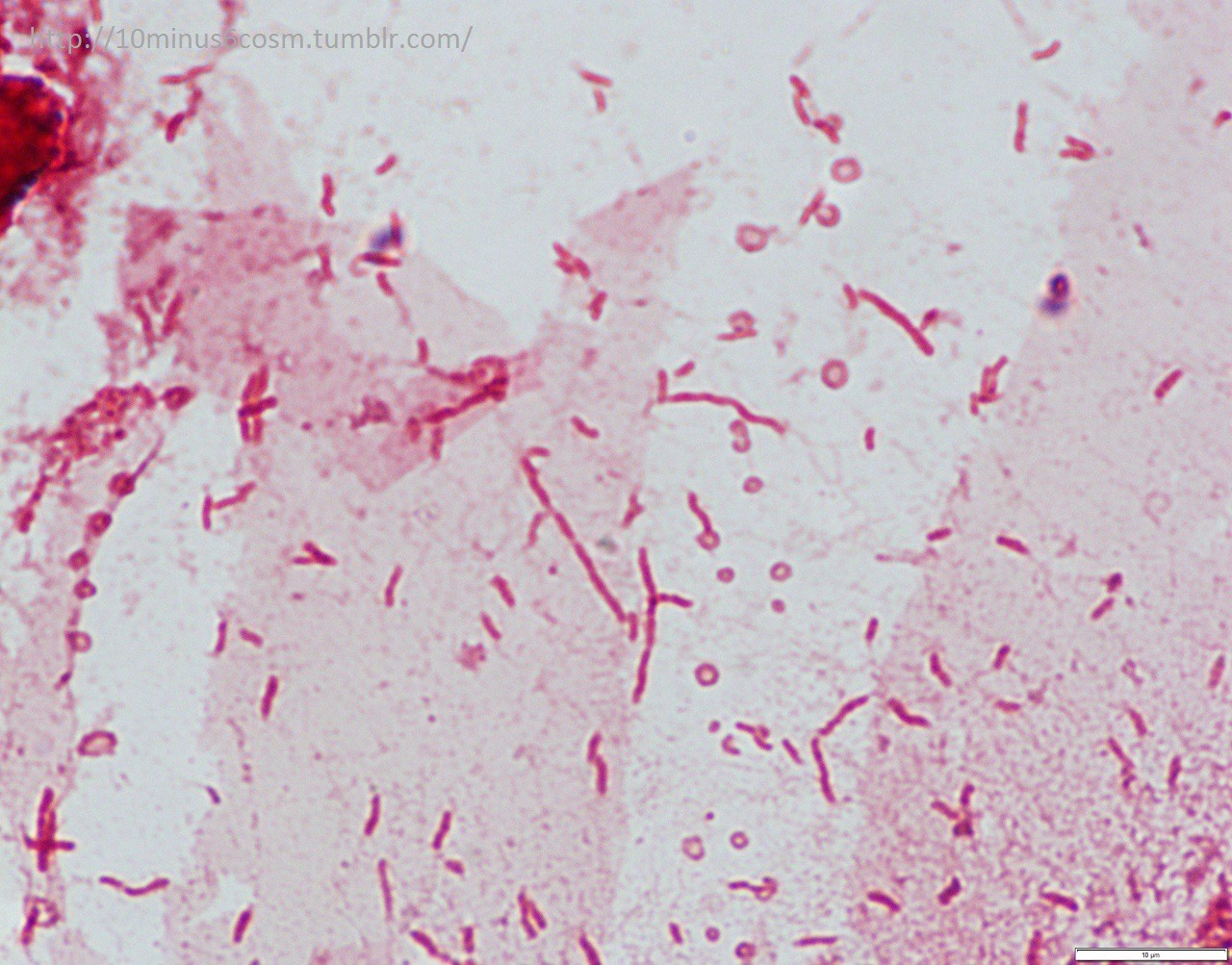 MICROCOSM | Laribacter hongkongensis