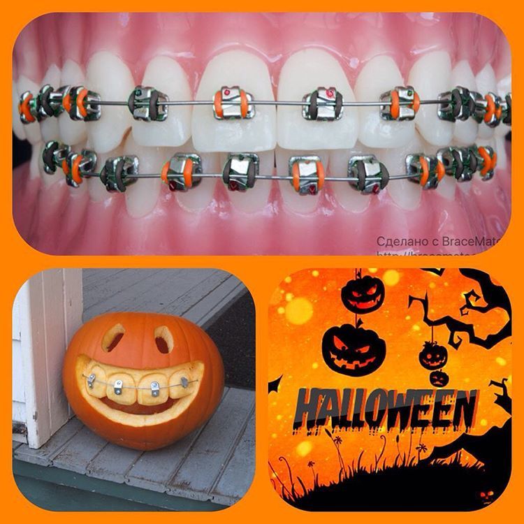 BraceMate — Get ready for #Halloween #orthodontics #braces...
