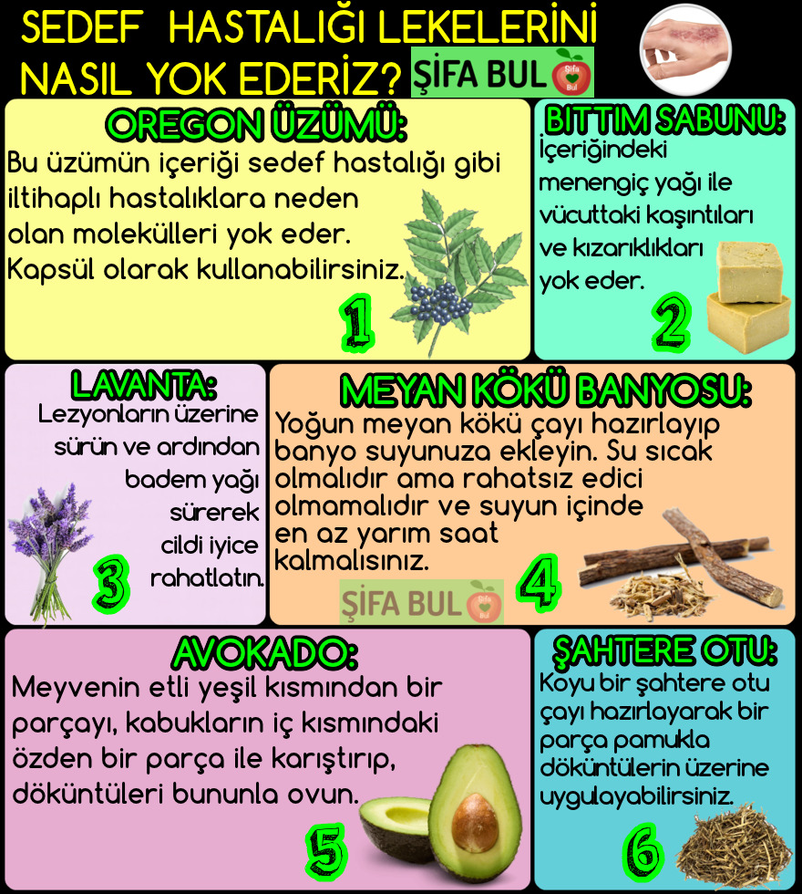 Sedef Hastalarının Beslenme Şekilleri Sedef Hastalarının Beslenme Şekilleri