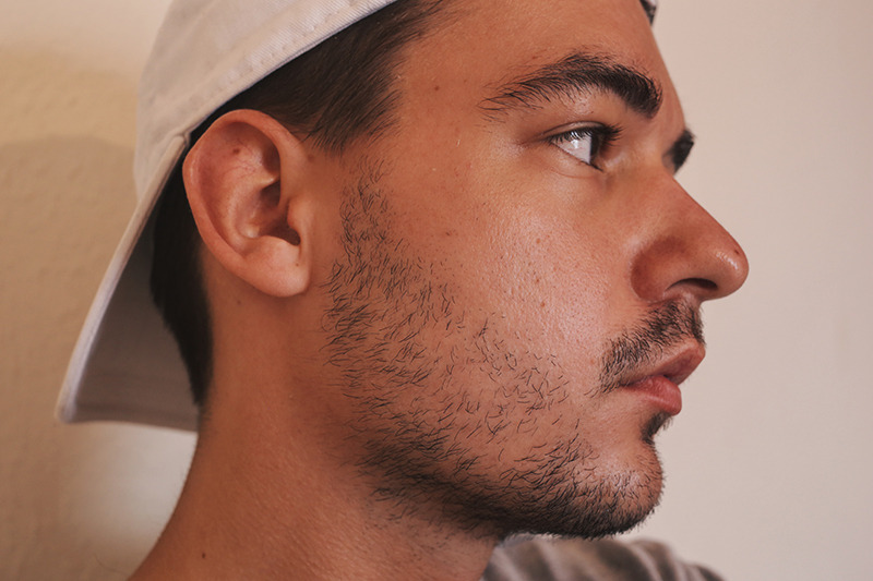 Minoxidil Beard En It Has Been 6 Weeks Since I Started Using