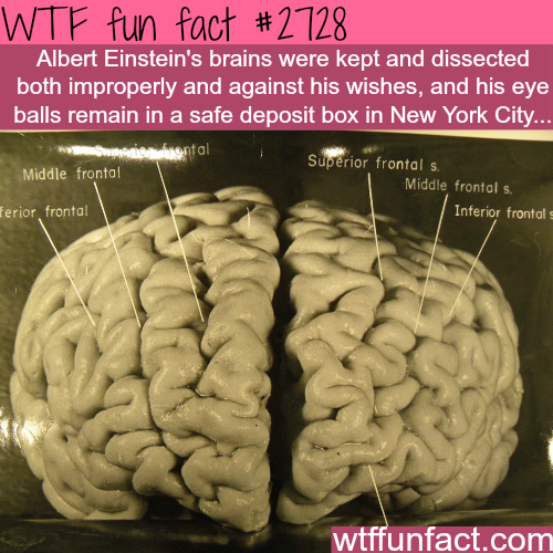 Albert Einsteins Brains Wtf Fun Facts