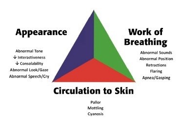 Student Paramedics — The Paediatric Assessment Triangle