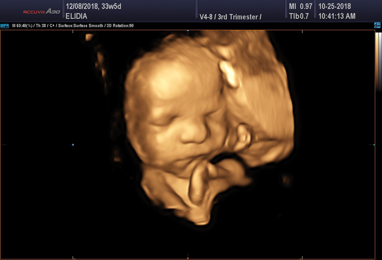 4d view ultrasound file