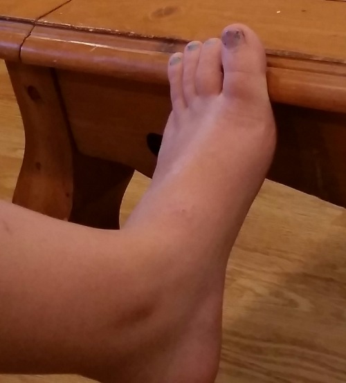 mysexygirlfriendsfeet:My sexy girlfriends teen daughter’s...