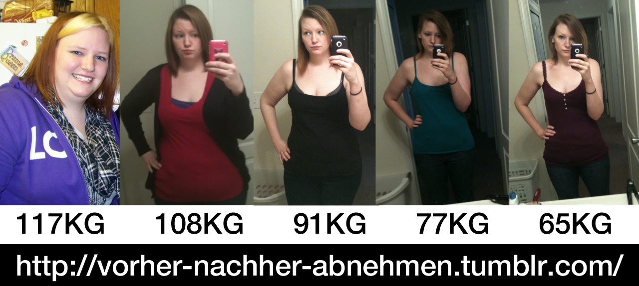 Vorher Nachher Abnehmen Bild