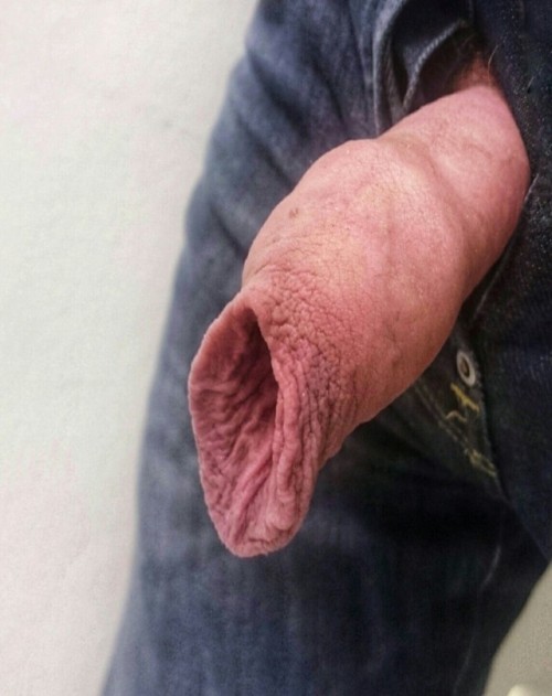 hugabearuk:4skins-and-fat-balls:My foreskin, wide and...