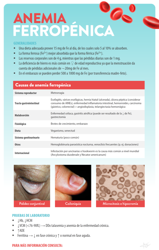 Hernia hiatal dieta pdf