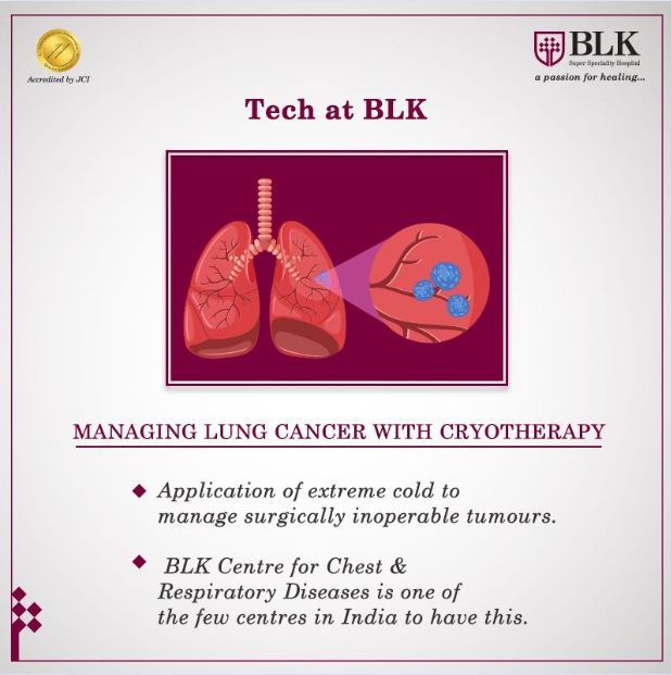 BLK Super Speciality Hospital — What is lung cancer?