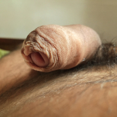 Adriger Penis Adriger Penis
