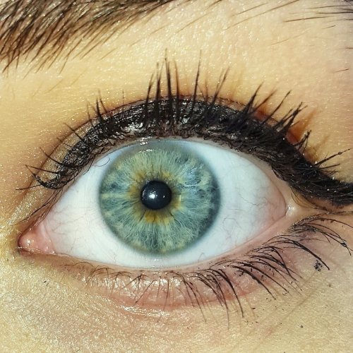 heterochromia iridum on Tumblr