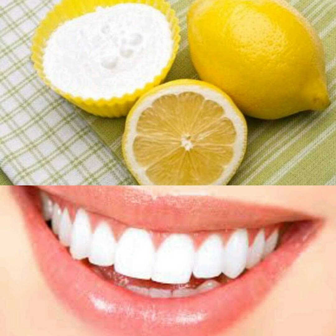 Makeupadda Diy Of The Day Whiten Your Teeth