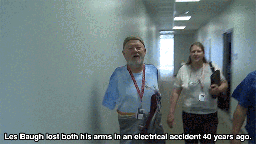 huffingtonpost:Man Successfully Controls 2 Prosthetic Arms...