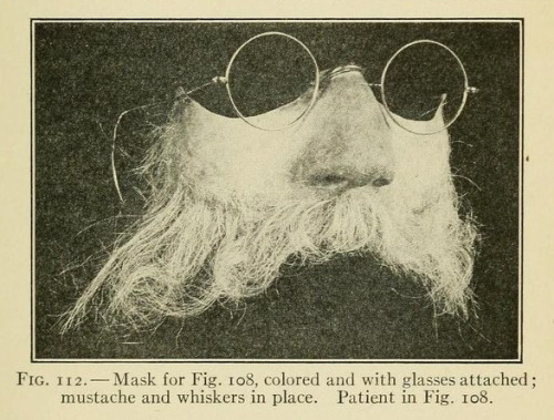 mask medical medicine face prosthesis plastic surgery 1918 1910s .5k