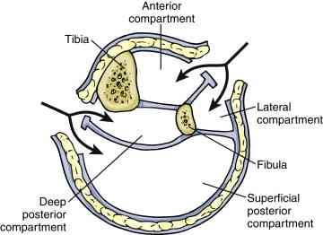 fasciotomy of leg