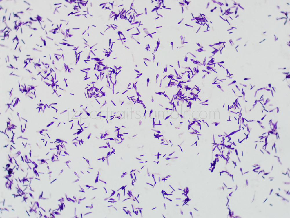 judy-z-gram-stain-clostridium-tertium-gram-positive-rod