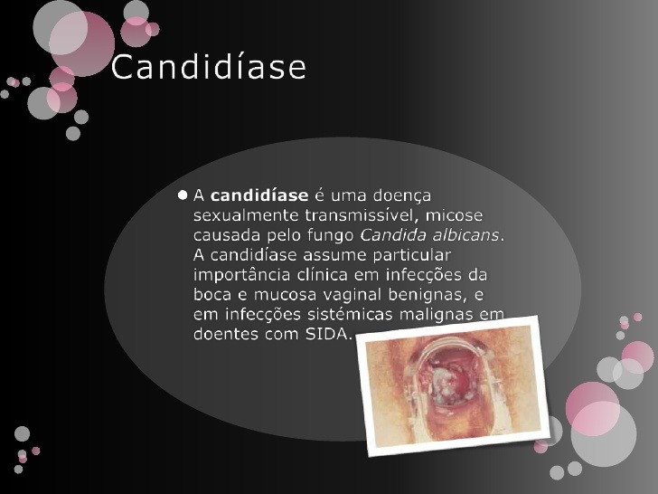 Candidiase genital como se transmite