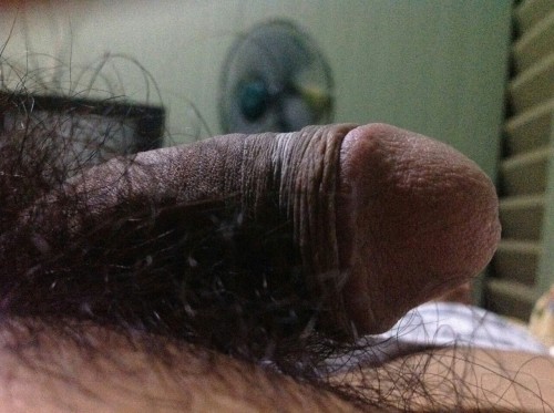 Hairy hairy