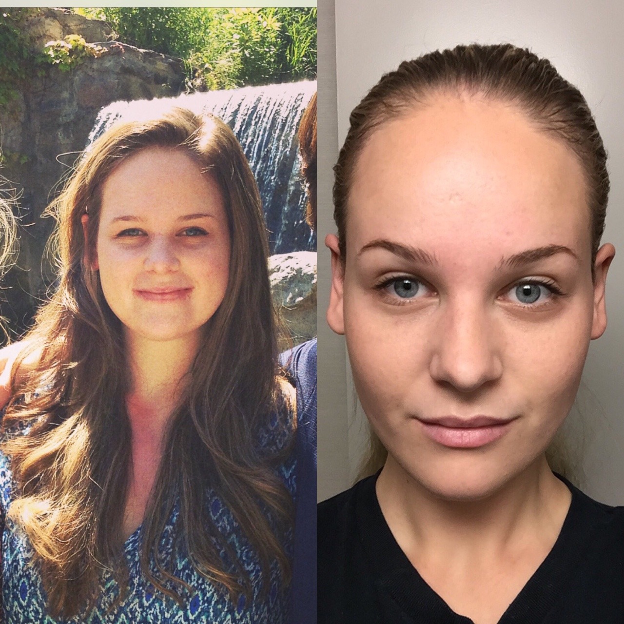 lose weight on face before and after